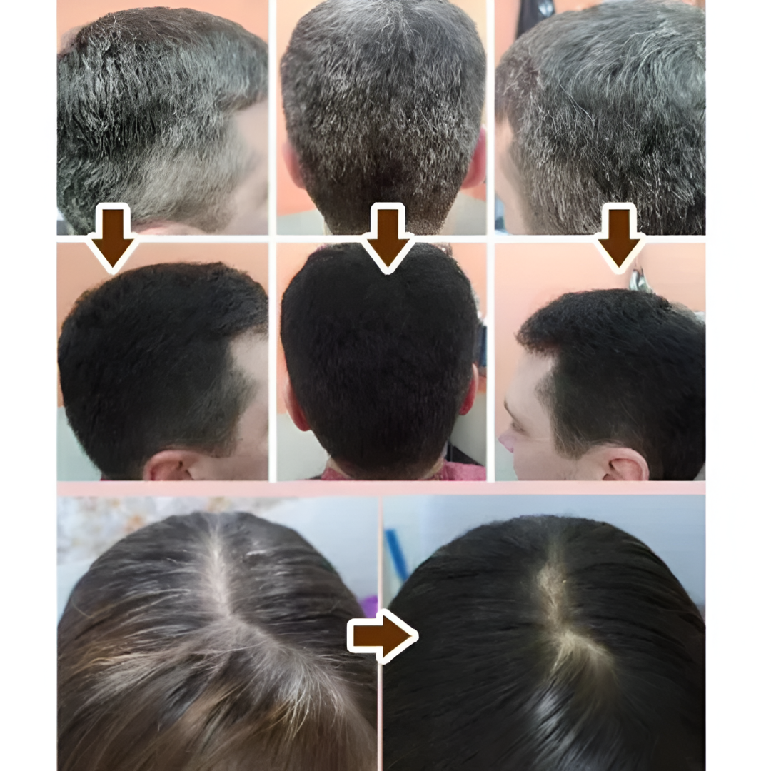 Shampoo Anticanas 100% Natural